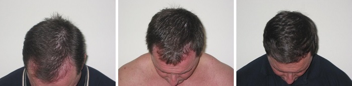 craig-mailer-before-during-after
